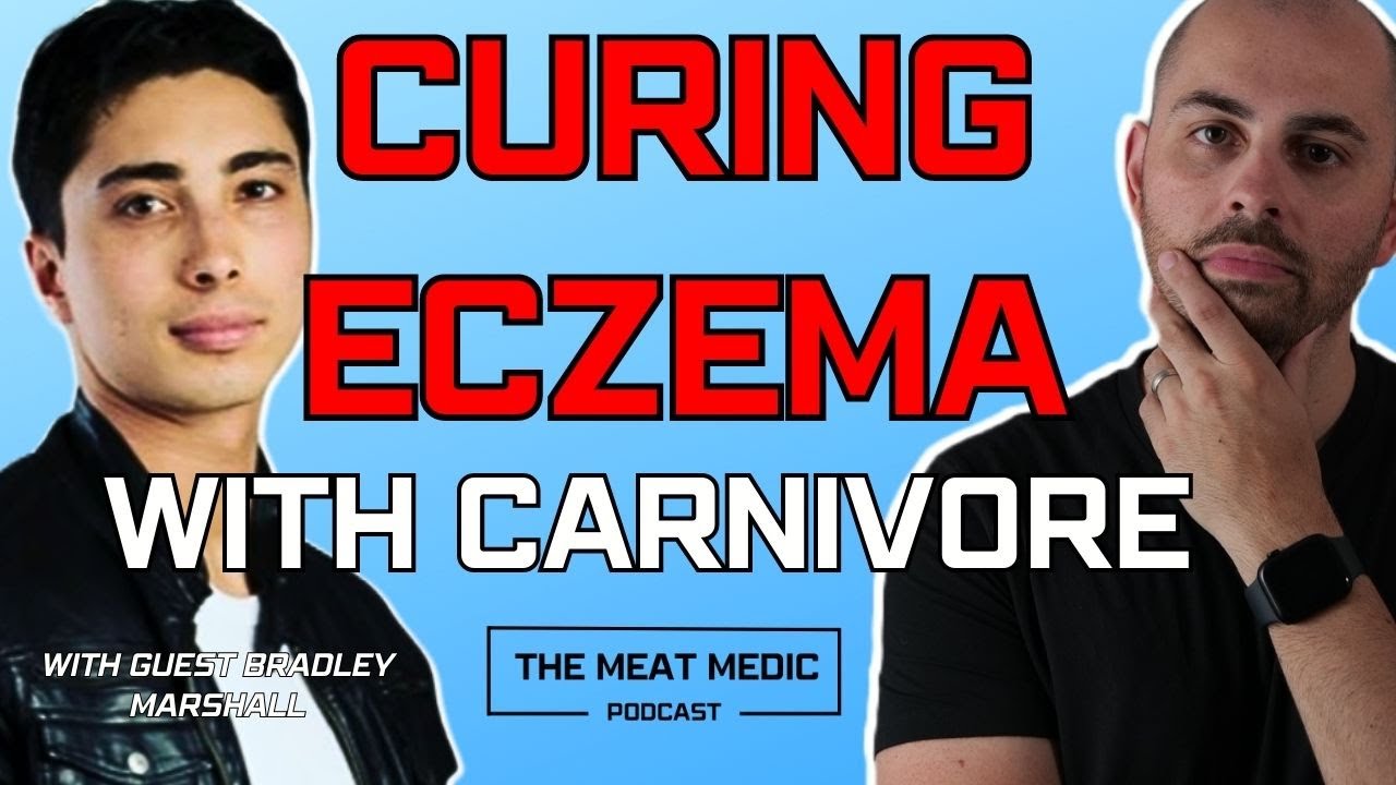 How to cure incurable eczema - Episode 09