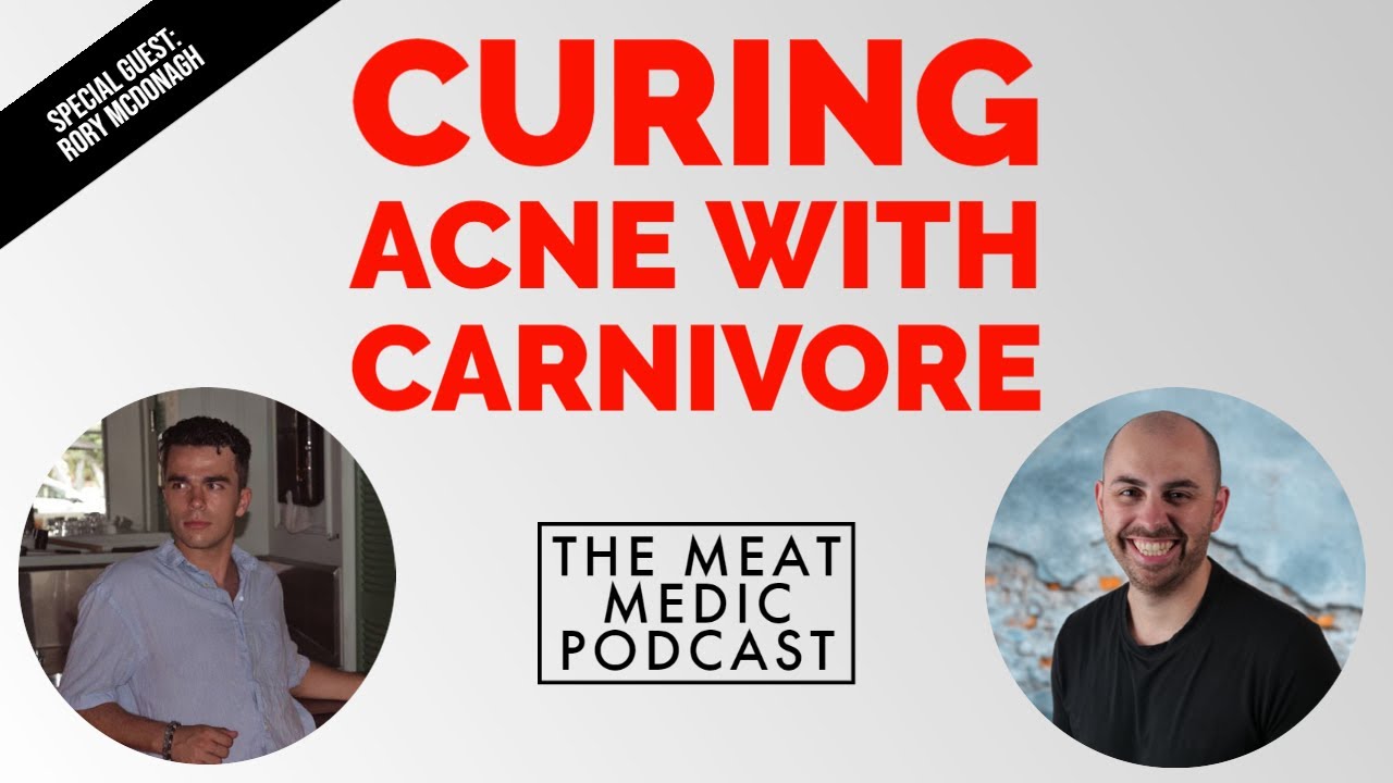 Curing his terrible acne with Carnivore Diet (and loads more benefits) -  Episode 11